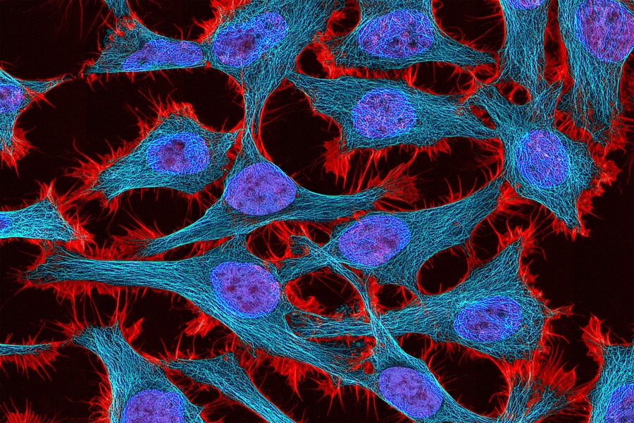 Precise Gene Therapy Control Precise Gene Therapy Control