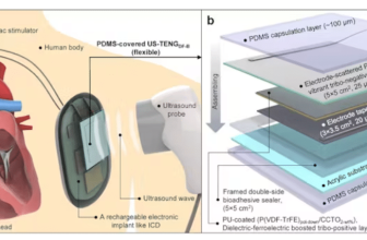 Ultrasound-Based Charging Tech For Implants
