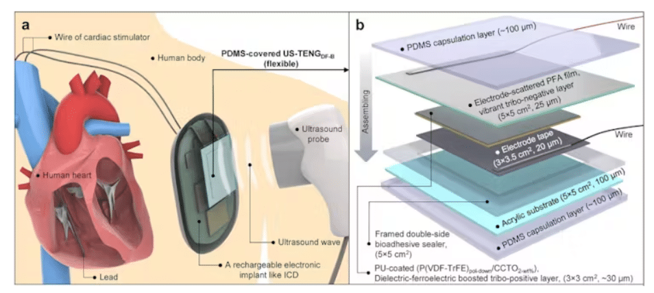 Ultrasound-Based Charging Tech For Implants Ultrasound-Based Charging Tech For Implants